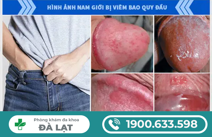 Hình ảnh minh họa