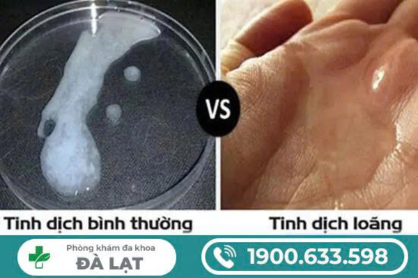 Hình ảnh minh họa