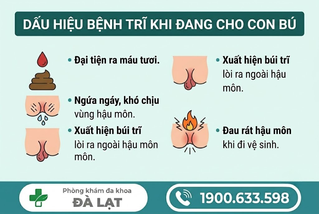Hình ảnh minh họa