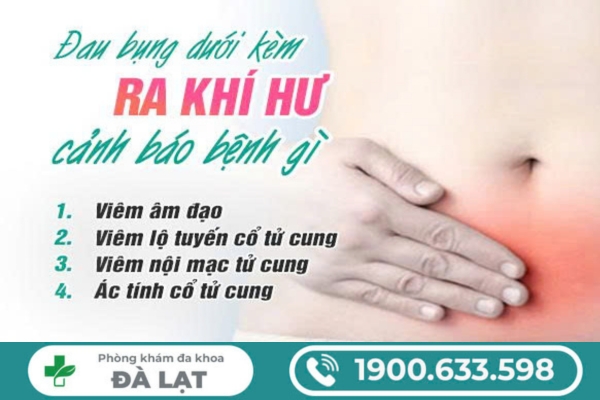 Hình ảnh minh họa