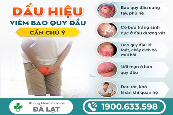 Hình ảnh minh họa