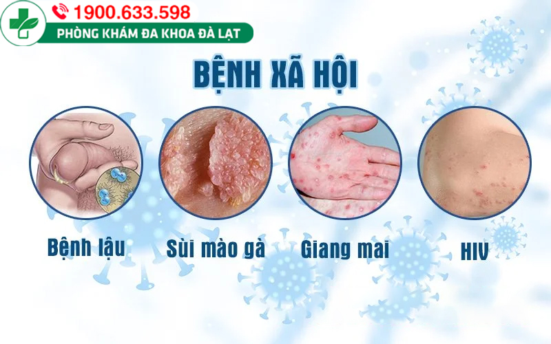 Hình ảnh minh họa