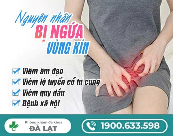 Hình ảnh minh họa