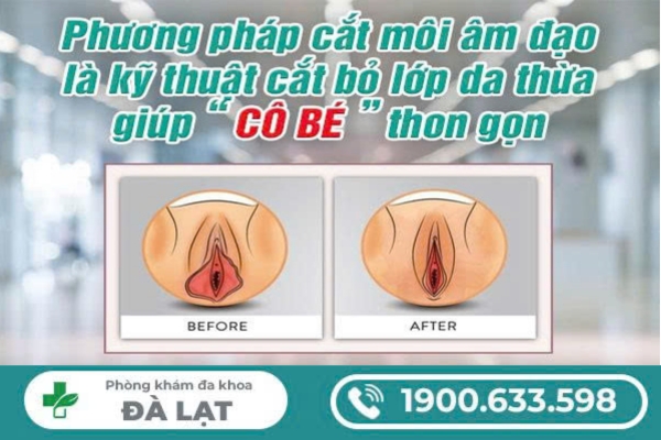 Hình ảnh minh họa