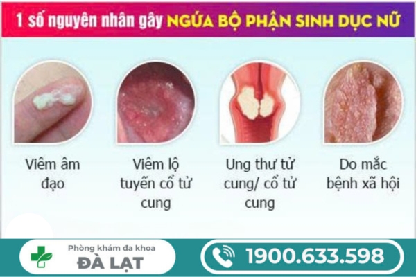 Hình ảnh minh họa