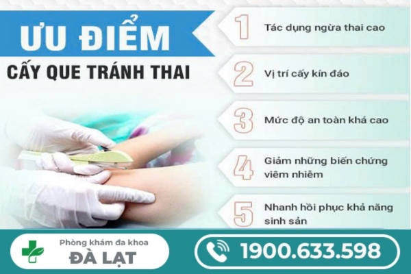 Hình ảnh minh họa