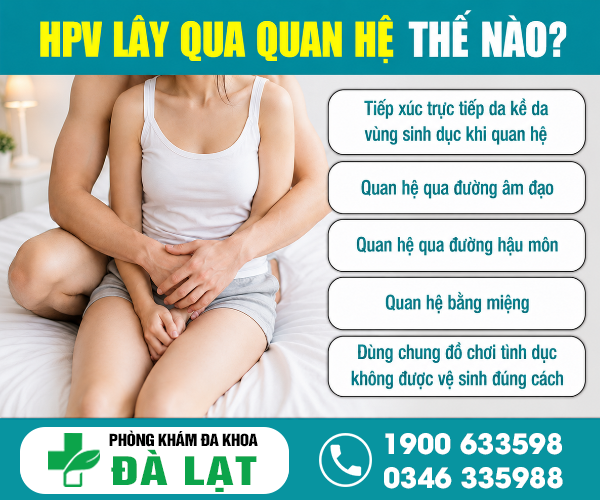Hình ảnh minh họa