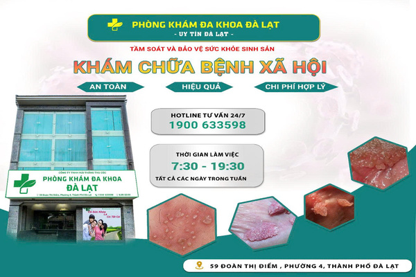 Hình ảnh minh họa