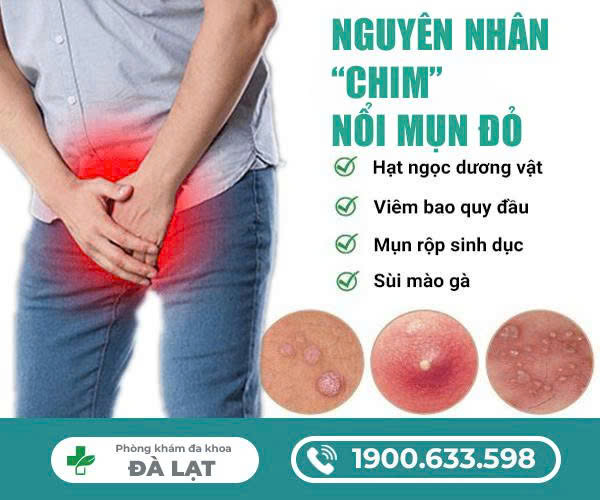 Hình ảnh minh họa