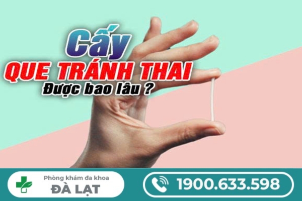 Hình ảnh minh họa