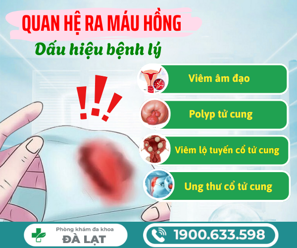 Hình ảnh minh họa