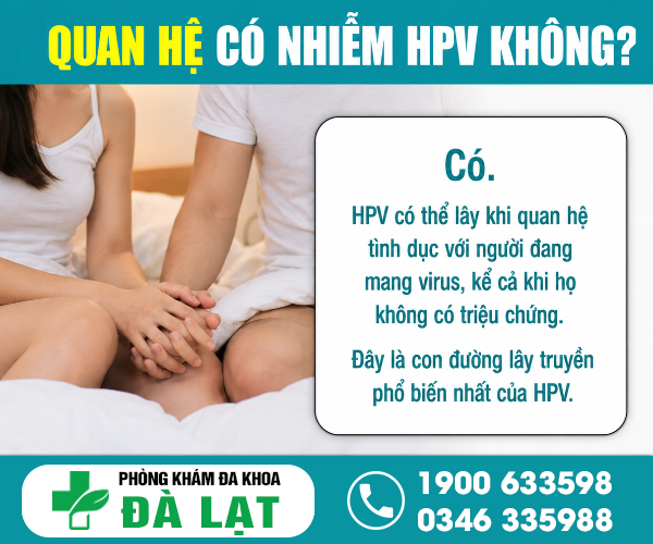 Hình ảnh minh họa