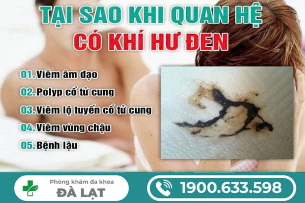 Hình ảnh minh họa