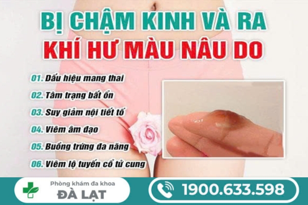 Hình ảnh minh họa