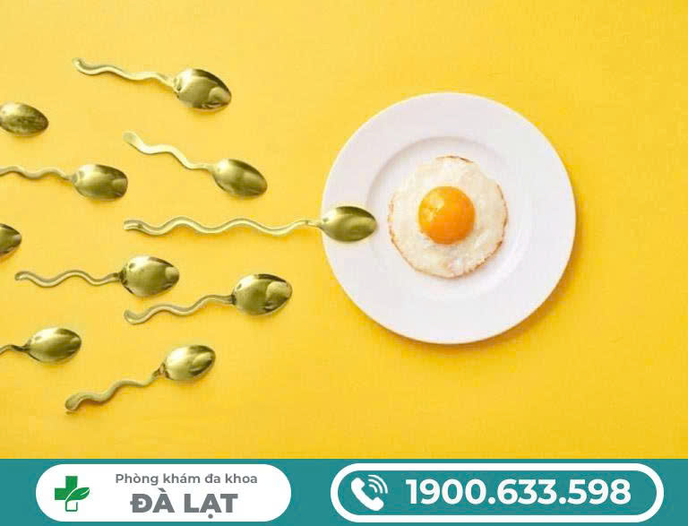 Hình ảnh minh họa