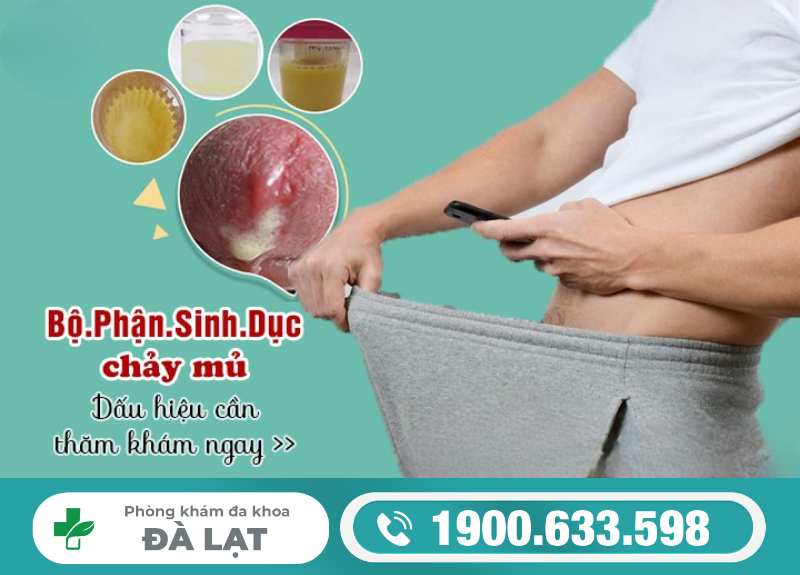 Hình ảnh minh họa