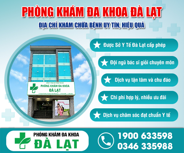 Hình ảnh minh họa