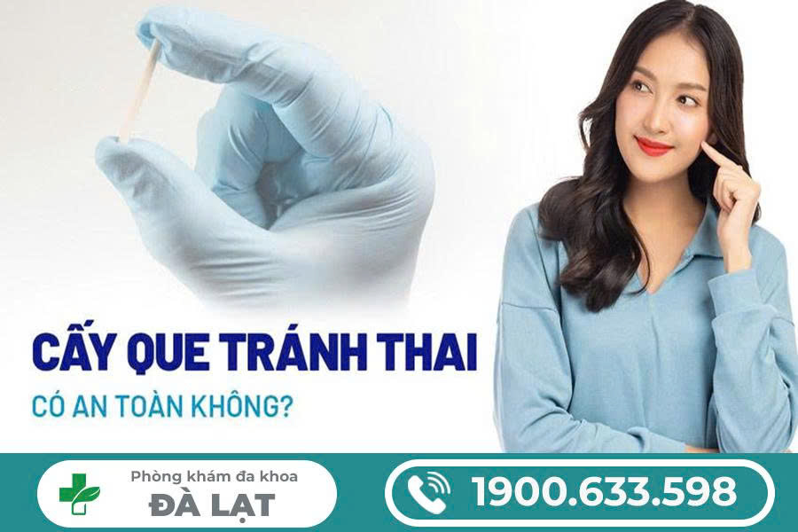 Hình ảnh minh họa