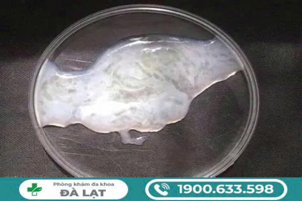 Hình ảnh minh họa