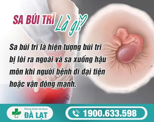 Hình ảnh minh họa