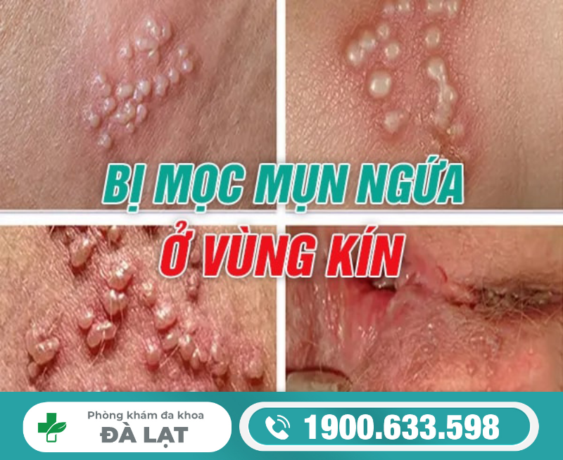 Hình ảnh minh họa