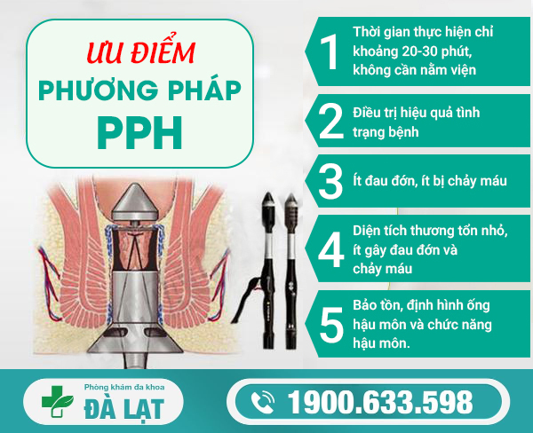 Hình ảnh minh họa